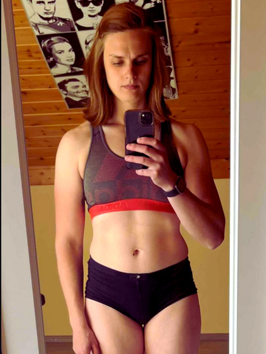 Sarah – Vorher